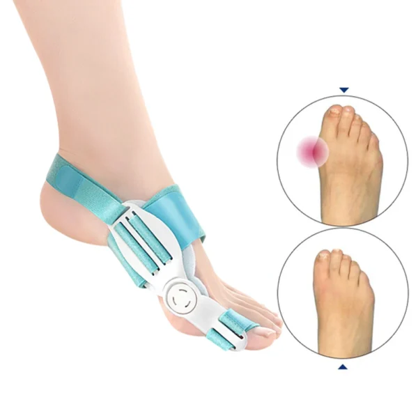⁦Bone Thumb Adjuster Orthotics Toe Straightener Foot Care⁩ - الصورة ⁦4⁩