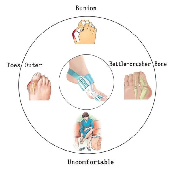 ⁦Bone Thumb Adjuster Orthotics Toe Straightener Foot Care⁩ - الصورة ⁦5⁩