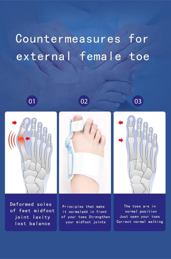 ⁦Bone Thumb Adjuster Orthotics Toe Straightener Foot Care⁩ - الصورة ⁦8⁩